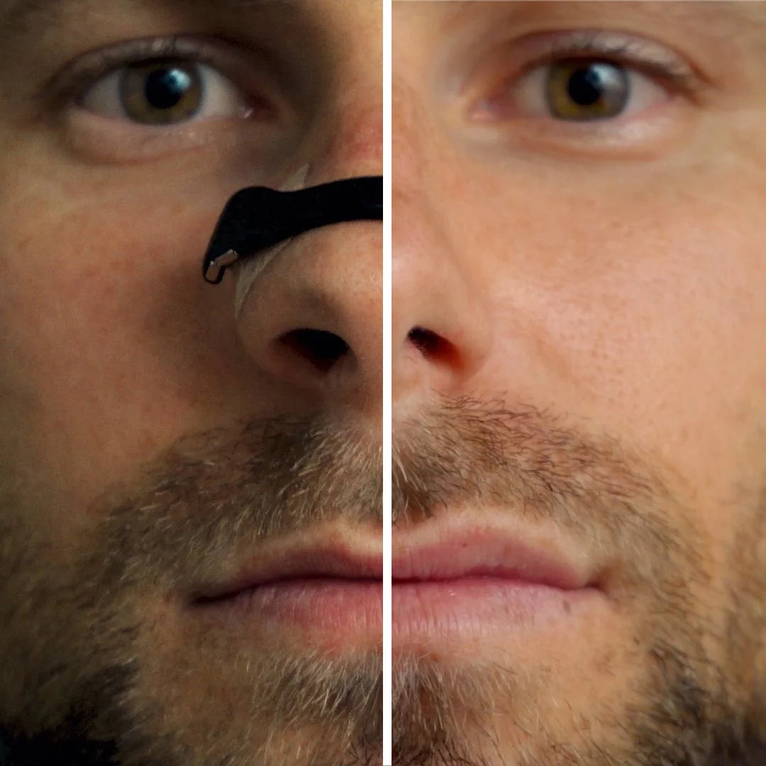 Oryon Magnetic Nasal Band