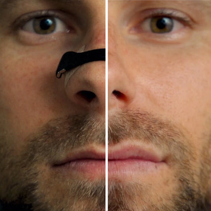Oryon Magnetic Nasal Band
